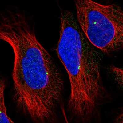 Deficiency Of Xanthine Oxidase: Disease Bioinformatics: Novus Biologicals