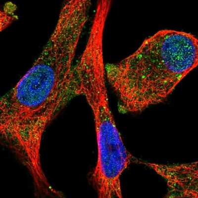 MMP-7 Antibody (NBP2-57142): Novus Biologicals