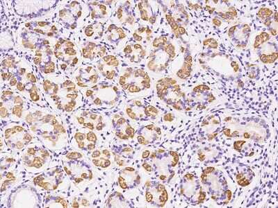 MT-CO2 Antibody (NBP2-97593): Novus Biologicals