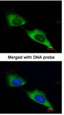 MTMR9 Antibody (NBP1-31078): Novus Biologicals