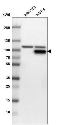 Muscle Phosphofructokinase/PFKM/PFK-1 Antibody (NBP1-87293): Novus ...