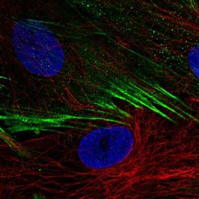 Nav1.7 Antibodies: Novus Biologicals