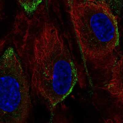 PI 3-Kinase p110 gamma Antibody (NBP2-57013): Novus Biologicals