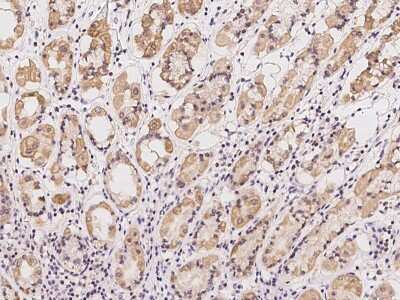 PNKD Antibody (NBP2-98628): Novus Biologicals