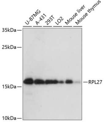 RPL27 Antibody (NBP2-94240): Novus Biologicals