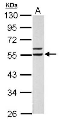 RXR alpha/NR2B1 Antibody (NBP2-20130): Novus Biologicals