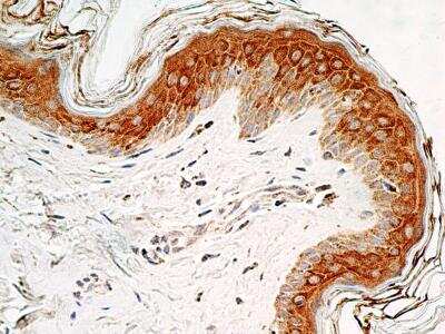 Immunohistochemistry-Paraffin: SOX11 Antibody