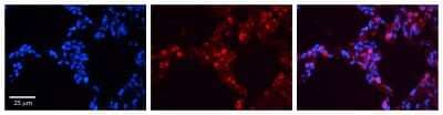 SP-B/Surfactant Protein B Antibody (NBP1-57977): Novus Biologicals