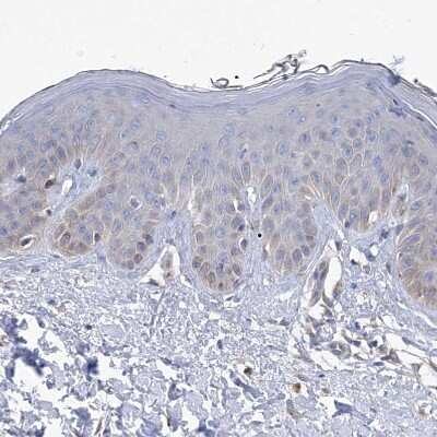 Spermine synthase Antibody (NBP1-87812): Novus Biologicals