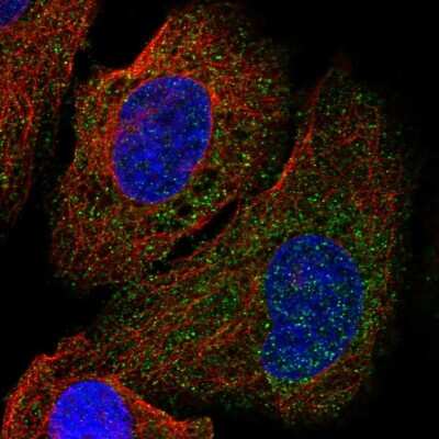 UNC5H1/Unc5a Antibody (NBP2-57451): Novus Biologicals