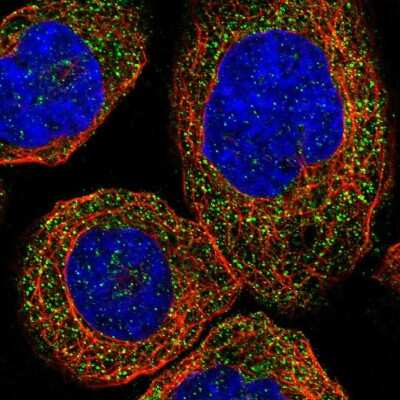 Zdhhc13 Antibody (nbp1-83822): Novus Biologicals