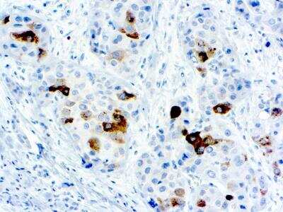 alpha-Fetoprotein/AFP Antibody (NB100-1611): Novus Biologicals