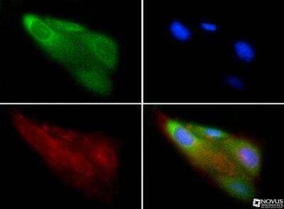 Microcystoid Retinal Degeneration: Disease Bioinformatics: Novus ...