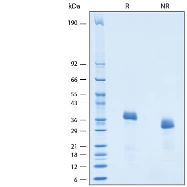 2 μg/lane of Recombinant Cynomolgus/Rhesus Macaque Dkk-1 Protein (Catalog # 10450-DK) was resolved with SDS-PAGE under reducing (R) and non-reducing (NR) conditions and visualized by Coomassie® Blue staining, showing bands at 35-39 kDa.