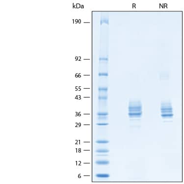 2 μg/lane of Recombinant Cynomolgus/Rhesus EpCAM/TROP1 His-tag Protein (Catalog # 10451-EP) was resolved with SDS-PAGE under reducing (R) and non-reducing (NR) conditions and visualized by Coomassie® Blue staining, showing bands at 30-43 kDa.