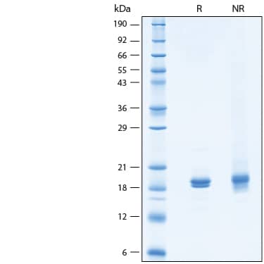 2 μg/lane of Recombinant Human NM23-H1 His-tag Protein (Catalog # 10495-NM) was resolved with SDS-PAGE under reducing (R) and non-reducing (NR) conditions and visualized by Coomassie® Blue staining, showing bands at 18-20 kDa.