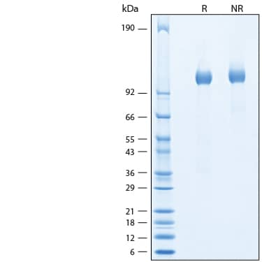 2 μg/lane of Recombinant Human MANBA Protein (Catalog # 10520-GH) was resolved with SDS-PAGE under reducing (R) and non-reducing (NR) conditions and visualized by Coomassie® Blue staining, showing bands at 110 kDa.