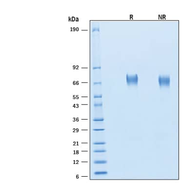 2 μg/lane of Recombinant Human IL-6R alpha His-tag Protein (Catalog # 10537-SR) was resolved with SDS-PAGE under reducing (R) and non-reducing (NR) conditions and visualized by Coomassie® Blue staining, showing bands at 67-73 kDa.