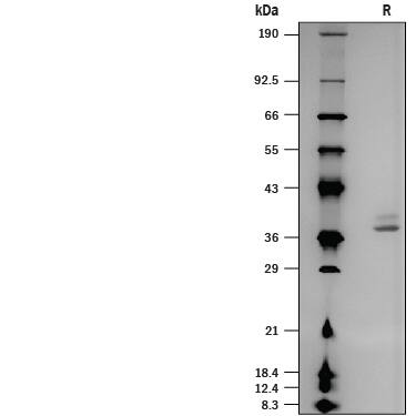 SDS-Page B4GALT7 [Unconjugated]