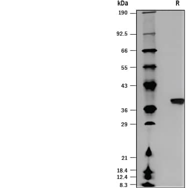 SDS-Page PANK2 [Unconjugated]