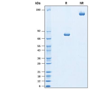 SDS-Page TIM-1/KIM-1/HAVCR [Unconjugated]