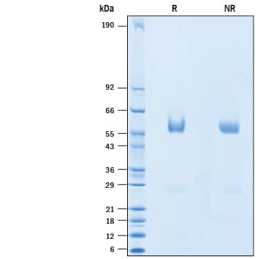 2 μg/lane of Recombinant Mouse TIM-1/KIM-1/HAVCR Isoform A His-tag (Catalog # 10700-TM) was resolved with SDS-PAGE under reducing (R) and non-reducing (NR) conditions and visualized by Coomassie® Blue staining, showing bands at 47-62 kDa.