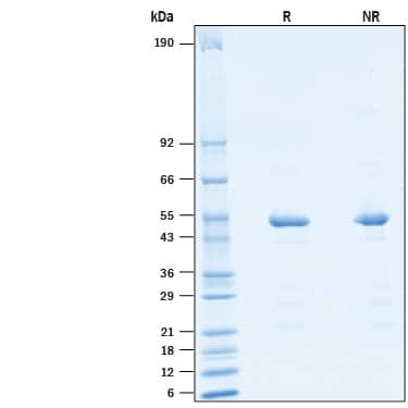 2 μg/lane of Recombinant HCoV-229E Nucleocapsid His-tag (Catalog # 10708-CV) was resolved with SDS-PAGE under reducing (R) and non-reducing (NR) conditions and visualized by Coomassie® Blue staining, showing bands at 48-53 kDa.