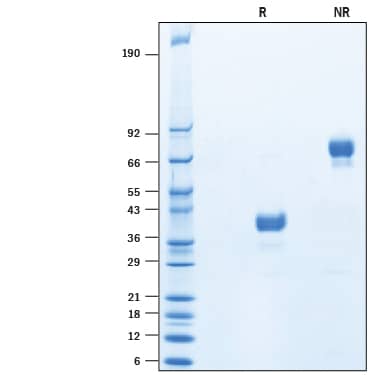 2 μg/lane of Recombinant Mouse CD52 Fc Chimera (Catalog # 10712-CD) was resolved with SDS-PAGE under reducing (R) and non-reducing (NR) conditions and visualized by Coomassie® Blue staining, showing bands at 32-42 kDa and 64-84 kDa, respectively.