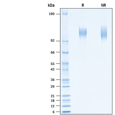 2 μg/lane of Recombinant SARS-CoV-2 A222V Spike S1 Subunit His-tag (Catalog # 10725-CV) was resolved with SDS-PAGE under reducing (R) and non-reducing (NR) conditions and visualized by Coomassie® Blue staining, showing bands at 108-122 kDa.