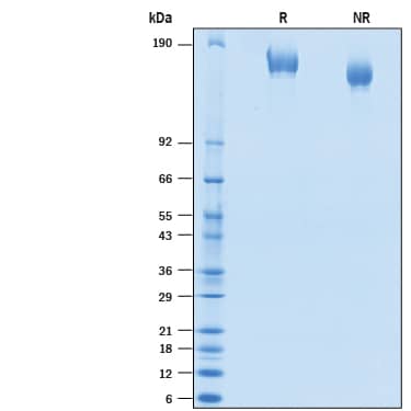 2 μg/lane of Recombinant SARS-CoV-2 Spike (Mink Cluster-5) His-tag (Catalog # 10736-CV) was resolved with SDS-PAGE under reducing (R) and non-reducing (NR) conditions and visualized by Coomassie® Blue staining, showing bands at 154-170 kDa.