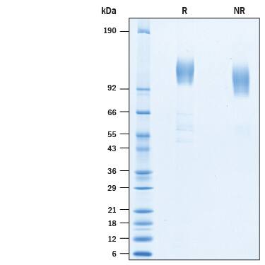 2 μg/lane of Recombinant SARS-CoV Spike S1 Subunit His-tag (Catalog # 10745-CV) was resolved with SDS-PAGE under reducing (R) and non-reducing (NR) conditions and visualized by Coomassie® Blue staining, showing bands at 109-121 kDa.