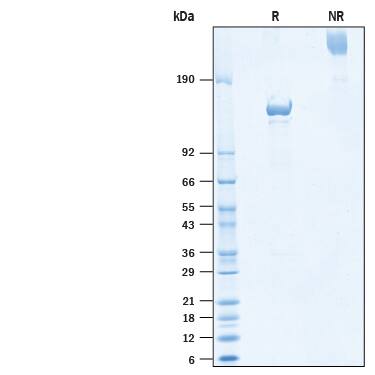 2 μg/lane of Recombinant Human CACHD1 Fc Chimera Protein (Catalog # 10749-CA) was resolved with SDS-PAGE under reducing (R) and non-reducing (NR) conditions and visualized by Coomassie® Blue staining, showing bands at 133-147 kDa and 260-300 kDa, respectively.
