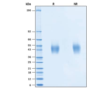 SDS-Page IL-7R alpha/CD127 [Unconjugated]