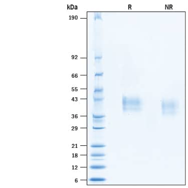 2 μg/lane of Recombinant Cynomolgus Monkey Mesothelin (aa417-693) His-tag (Catalog # 10764-MS) was resolved with SDS-PAGE under reducing (R) and non-reducing (NR) conditions and visualized by Coomassie® Blue staining, showing bands at 35-45 kDa.