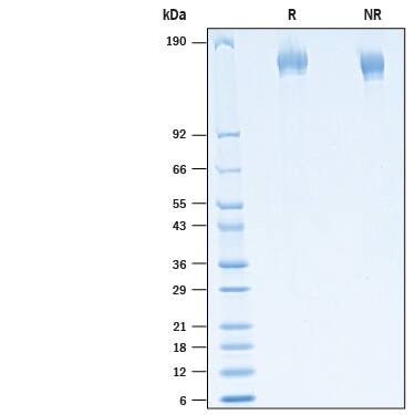 2 μg/lane of Recombinant SARS-CoV-2 20C-US Spike His-tag (Catalog # 10769-CV) was resolved with SDS-PAGE under reducing (R) and non-reducing (NR) conditions and visualized by Coomassie® Blue staining, showing bands at 135-167 kDa.