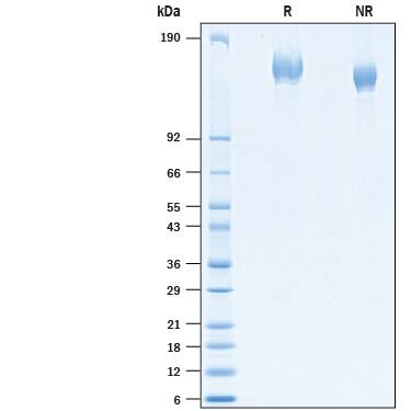 2 μg/lane of Recombinant SARS-CoV-2 B.1.351 Spike His-tag (Catalog # 10777-CV) was resolved with SDS-PAGE under reducing (R) and non-reducing (NR) conditions and visualized by Coomassie® Blue staining, showing bands at 133-164 kDa.