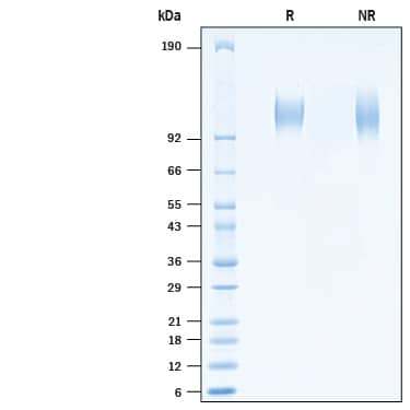 2 μg/lane of Recombinant SARS-CoV-2 20C-US S1 Subunit His-tag (Catalog # 10778-CV) was resolved with SDS-PAGE under reducing (R) and non-reducing (NR) conditions and visualized by Coomassie® Blue staining, showing bands at 105-117 kDa.