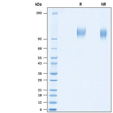 2 μg/lane of Recombinant SARS-CoV-2 CAL.20C S1 Subunit His-tag (Catalog # 10779-CV) was resolved with SDS-PAGE under reducing (R) and non-reducing (NR) conditions and visualized by Coomassie® Blue staining, showing bands at 105-117 kDa.