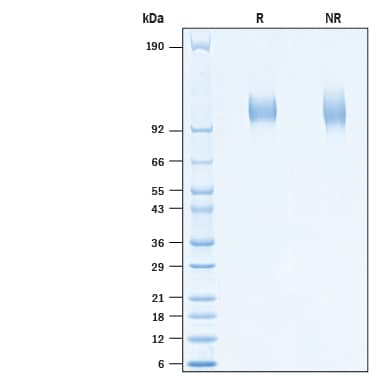 2 μg/lane of Recombinant SARS-CoV-2 20A.EU2 S1 Subunit His-tag (Catalog # 10780-CV) was resolved with SDS-PAGE under reducing (R) and non-reducing (NR) conditions and visualized by Coomassie® Blue staining, showing bands at 102-114 kDa.
