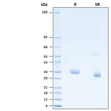 2 μg/lane of Recombinant SARS-CoV-2 E484L N501Y Spike RBD His-tag (Catalog # 10788-CV) was resolved with SDS-PAGE under reducing (R) and non-reducing (NR) conditions and visualized by Coomassie® Blue staining, showing bands at 32-40 kDa.