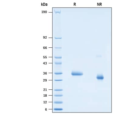 2 μg/lane of Recombinant SARS-CoV-2 S494P Spike RBD His-tag Protein (Catalog # 10789-CV) was resolved with SDS-PAGE under reducing (R) and non-reducing (NR) conditions and visualized by Coomassie® Blue staining, showing bands at 32-40 kDa.