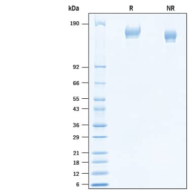 2 μg/lane of Recombinant SARS-CoV-2 P.1 Spike GCN4-IZ His-tag (Catalog # 10795-CV) was resolved with SDS-PAGE under reducing (R) and non-reducing (NR) conditions and visualized by Coomassie® Blue staining, showing bands at 140-170 kDa.