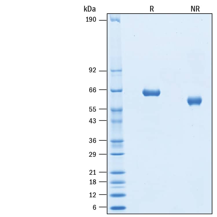 2 μg/lane of Recombinant Human Plexin B1 His-tag (Catalog # 10803-PB) was resolved with SDS-PAGE under reducing (R) and non-reducing (NR) conditions and visualized by Coomassie® Blue staining, showing bands at 60-68 kDa.