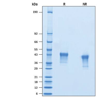 2 μg/lane of Recombinant Cynomolgus Monkey VSIG4 His-tag (Catalog # 10807-VS) was resolved with SDS-PAGE under reducing (R) and non-reducing (NR) conditions and visualized by Coomassie® Blue staining, showing bands at 35-45 kDa.