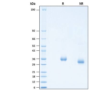 2 μg/lane of Recombinant SARS-CoV-2 Y489K Spike RBD His-tag (Catalog # 10811-CV) was resolved with SDS-PAGE under reducing (R) and non-reducing (NR) conditions and visualized by Coomassie® Blue staining, showing bands at 26-38 kDa.