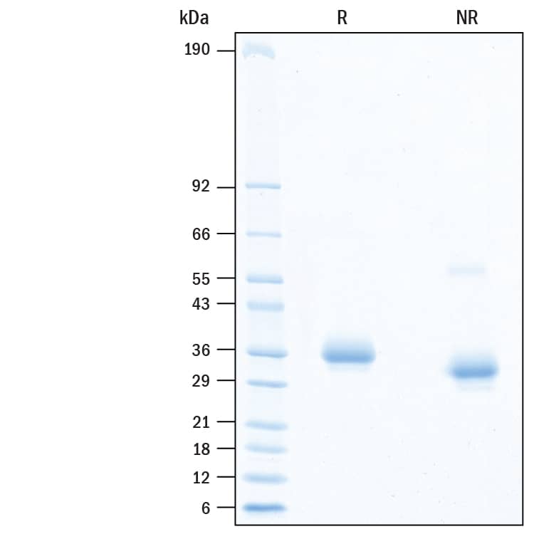 2 μg/lane of Recombinant SARS-CoV-2 F486V Spike RBD His-tag (Catalog # 10812-CV) was resolved with SDS-PAGE under reducing (R) and non-reducing (NR) conditions and visualized by Coomassie® Blue staining, showing bands at 31-38 kDa.