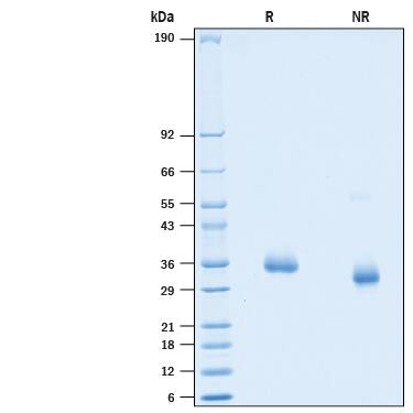 2 μg/lane of Recombinant SARS-CoV-2 A475V Spike RBD His-tag (Catalog # 10813-CV) was resolved with SDS-PAGE under reducing (R) and non-reducing (NR) conditions and visualized by Coomassie® Blue staining, showing bands at 32-38 kDa.