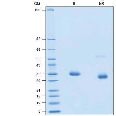 2 μg/lane of Recombinant SARS-CoV-2 K417E Spike RBD His-tag Protein (Catalog # 10816-CV) was resolved with SDS-PAGE under reducing (R) and non-reducing (NR) conditions and visualized by Coomassie® Blue staining, showing bands at 33-39 kDa.