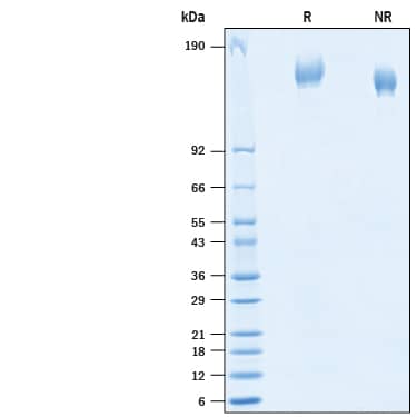 2 μg/lane of Recombinant SARS-CoV-2 +E484K B.1.1.7 Spike (GCN4-IZ) His-tag Protein (Catalog # 10824-CV) was resolved with SDS-PAGE under reducing (R) and non-reducing (NR) conditions and visualized by Coomassie® Blue staining, showing bands at 140-170 kDa.