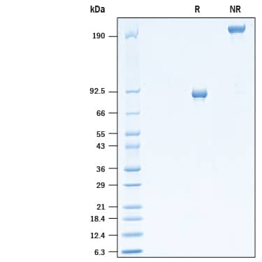 2 μg/lane of Recombinant Cynomolgus Monkey MMP-9 (Catalog # 10833-MP) was resolved with SDS-PAGE under reducing (R) and non-reducing (NR) conditions and visualized by Coomassie® Blue staining, showing bands at ~90 kDa under reducing conditions.